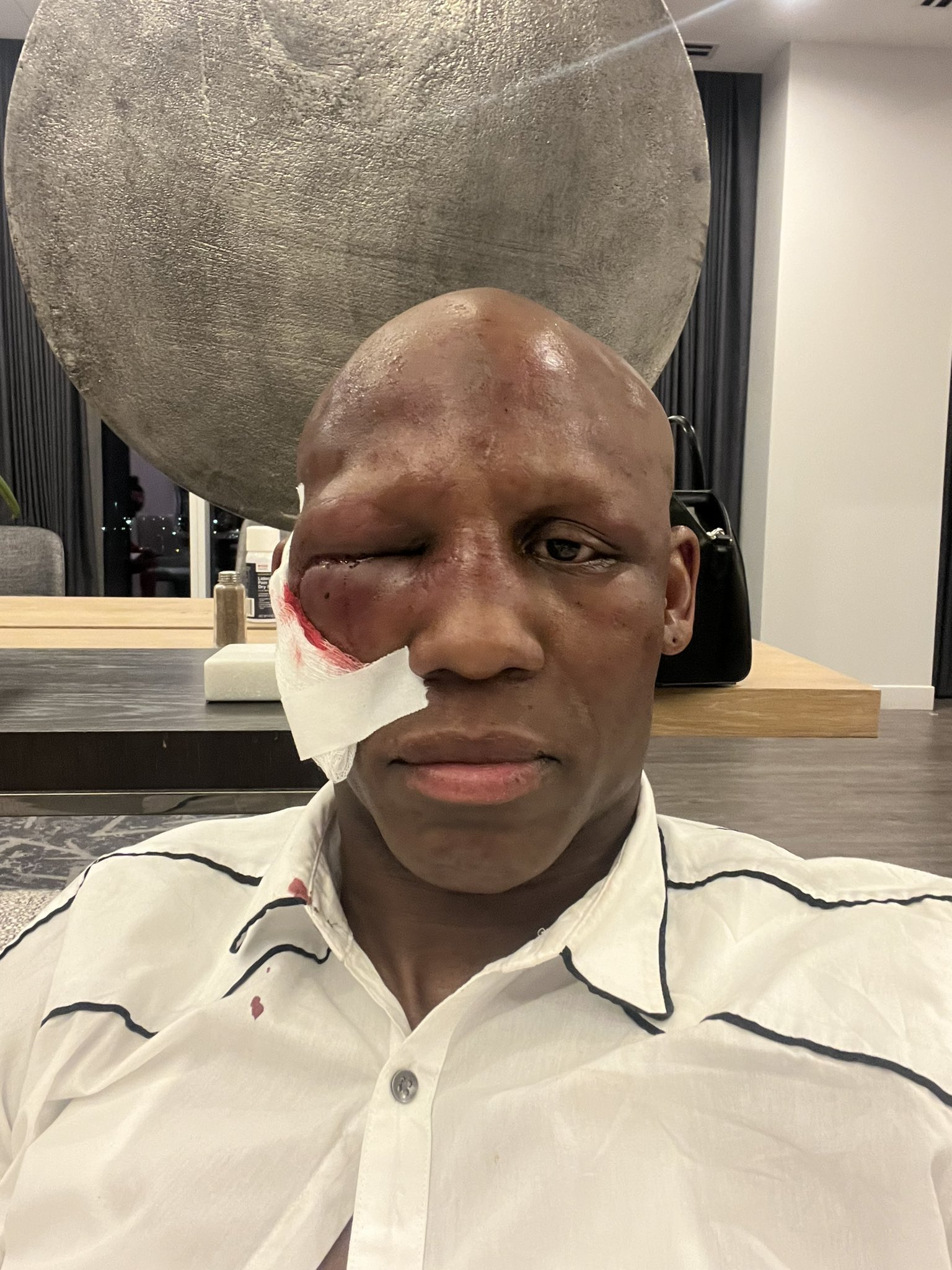 Ugas shows effects of Spence fight